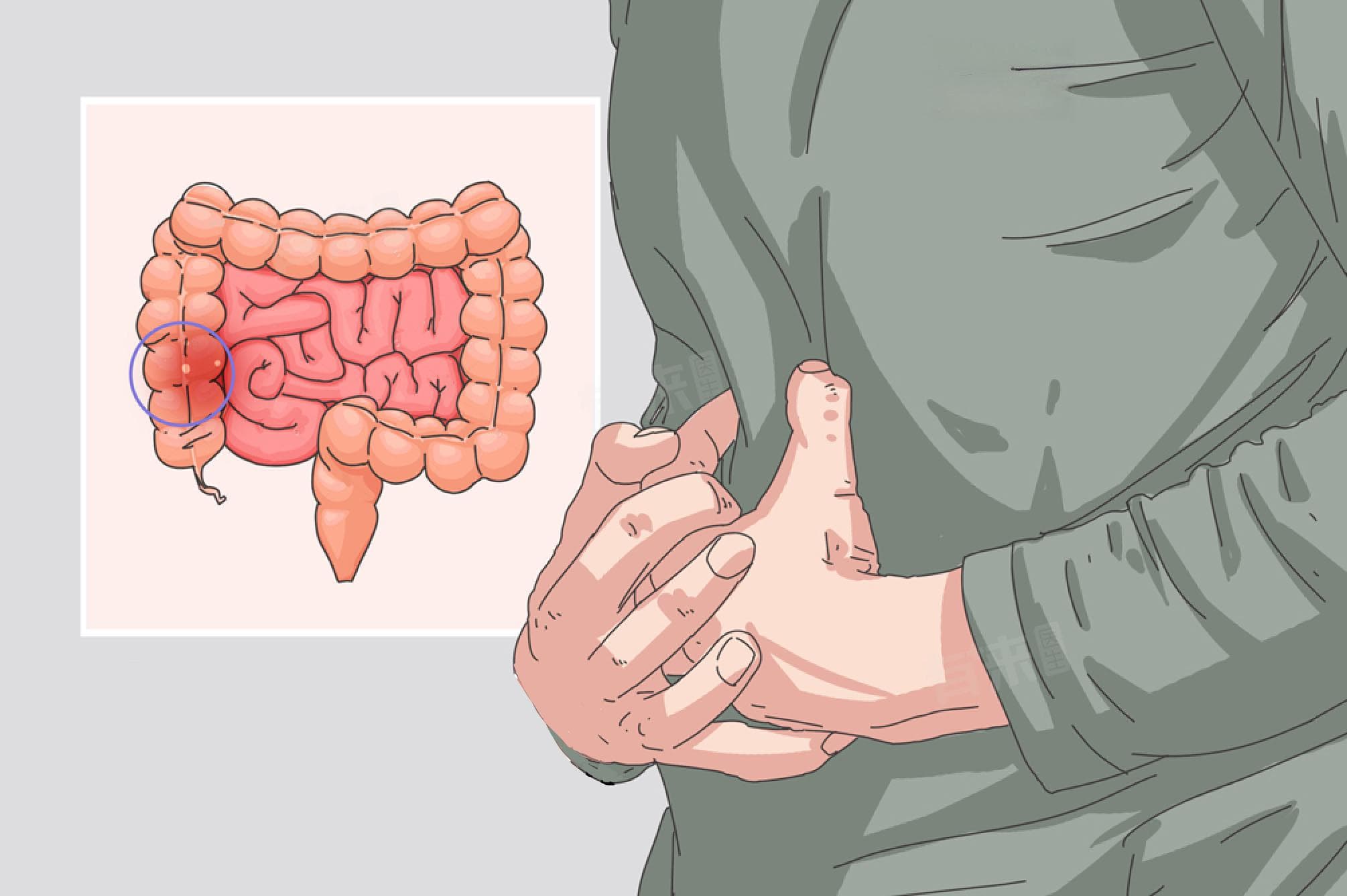 怎么判断是不是秋季腹泻