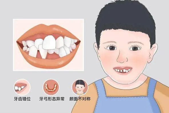 几岁正畸最好？正畸专家详解儿童牙齿矫正全攻略