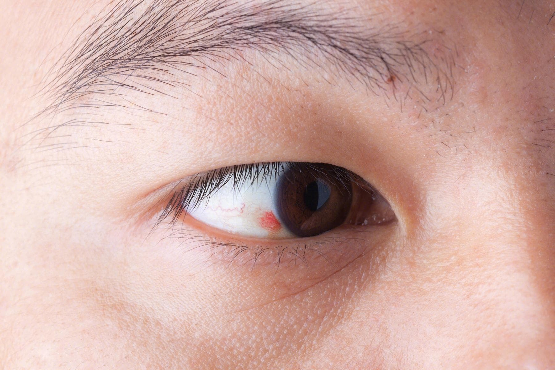 肝病早知道：5种晨起症状和4大护肝原则