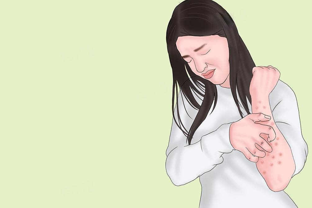胆碱能性荨麻疹是怎么患上的