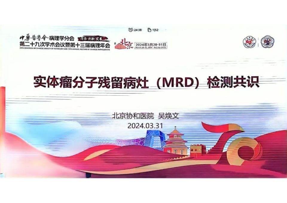 实体瘤分子残留灶（MRD）检测共识