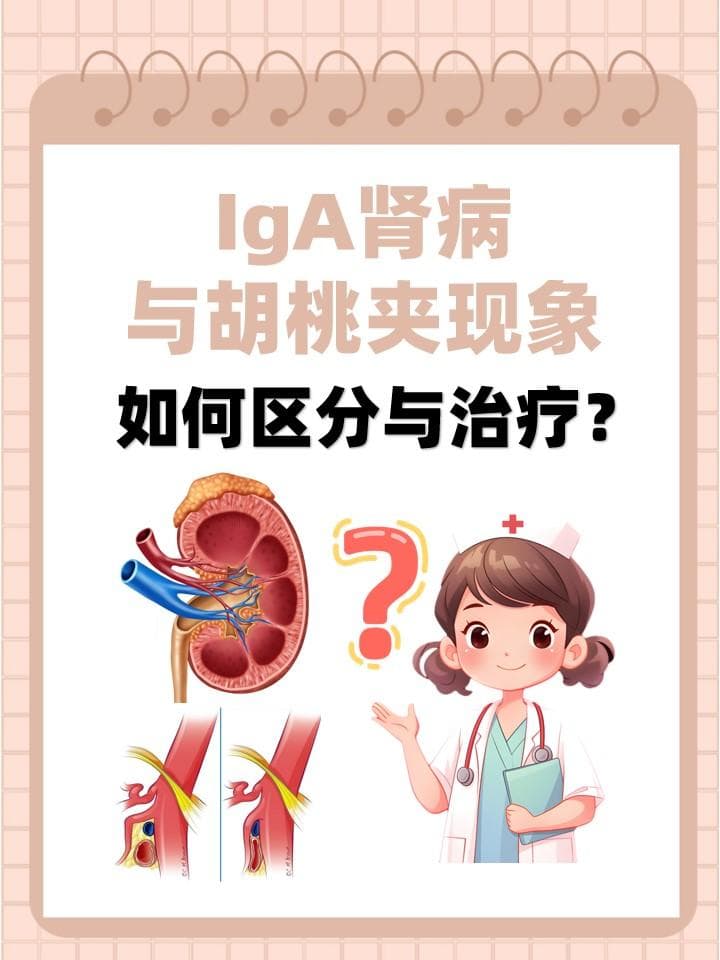 IgA肾病与胡桃夹现象：如何区分与治疗？