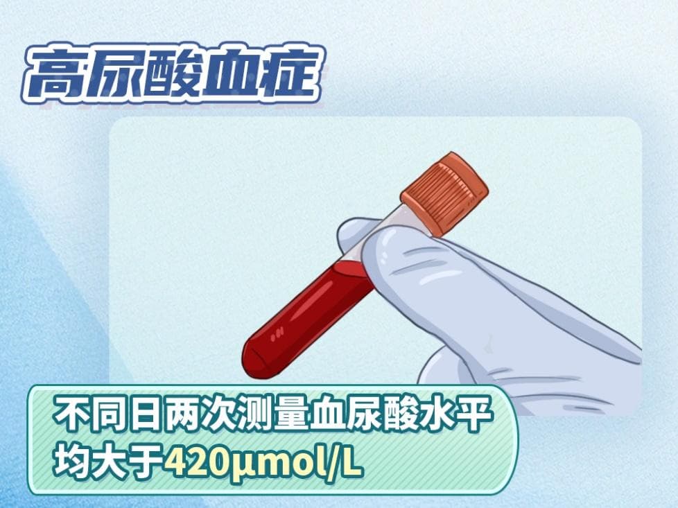 痛风和尿酸有着怎样的关系？如何预防痛风发作？