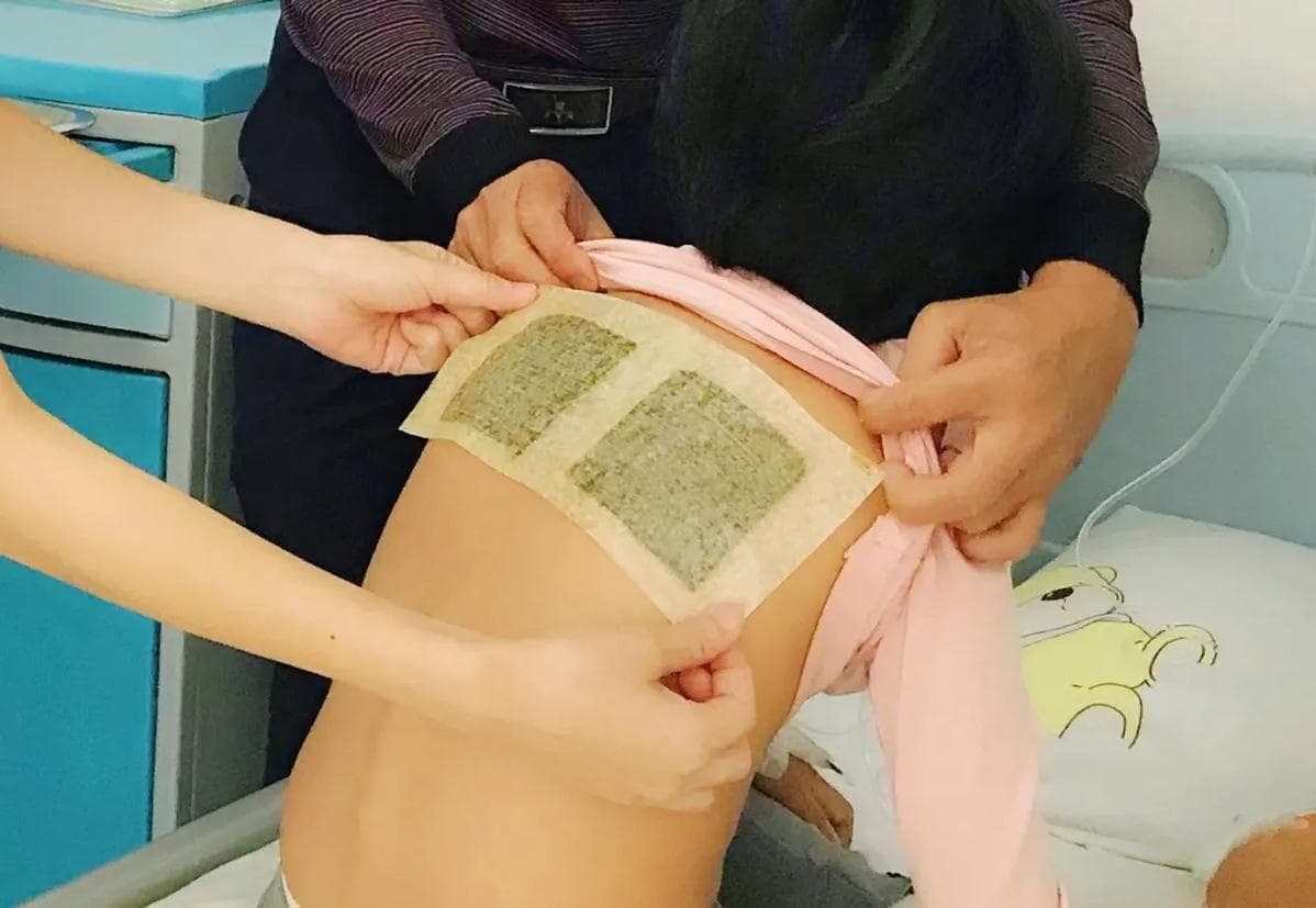 百日咳流行季，孩子久咳不愈可尝试中医疗法