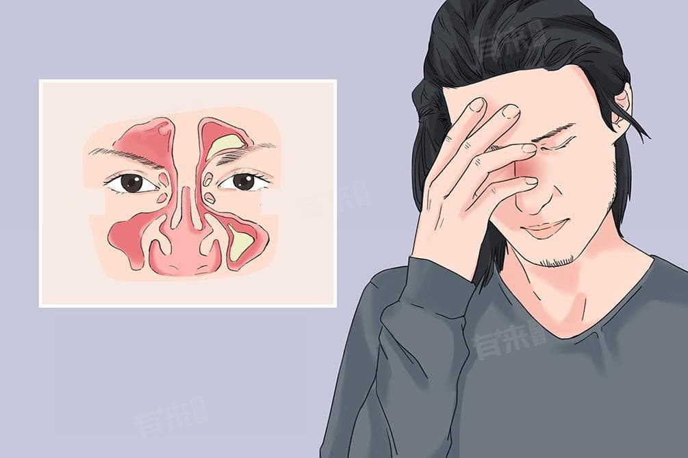 鼻窦炎七大禁忌及治疗方法