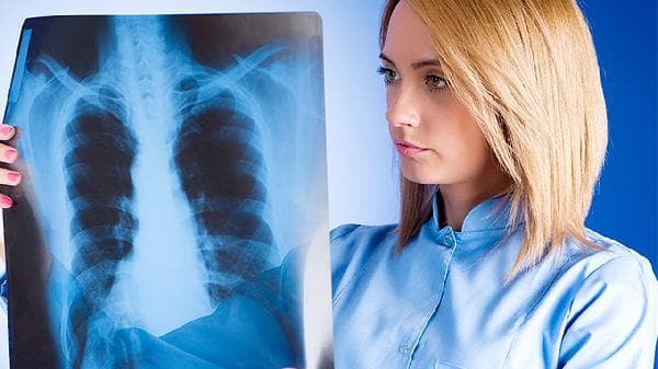 间质性肺病：病因、症状与治疗全解析