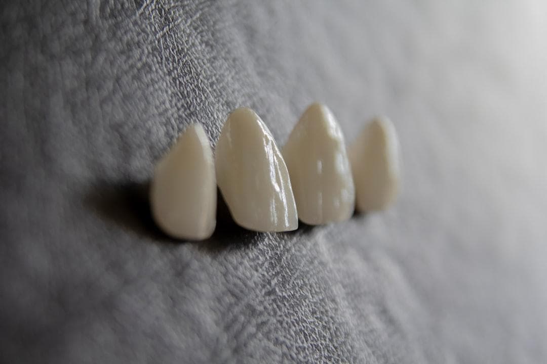牙齿神经痛是否会自行好转？专业牙医解析病因与治疗方案