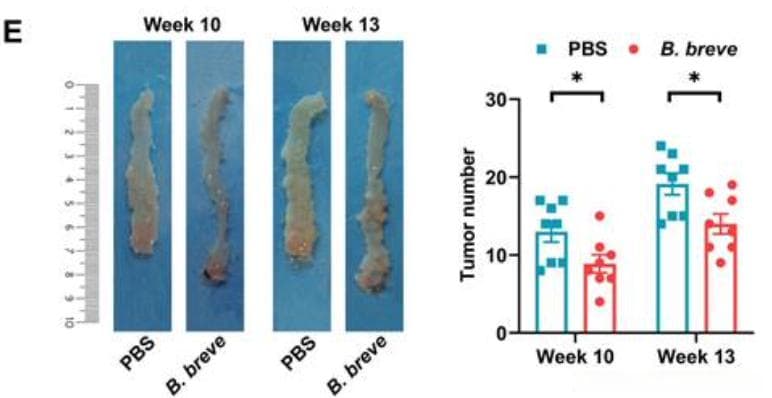 吃这种益生菌可以预防结肠癌？北大团队发现益生菌抗癌新靶点