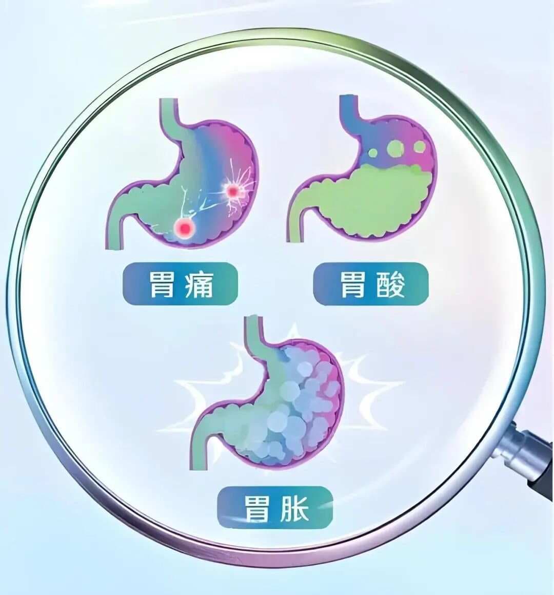 胃反酸的中医辨证论治：从病因病机到严重演变及古法调治