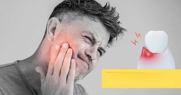牙龈肿痛怎么办？从中医证候、经络与中药理解！