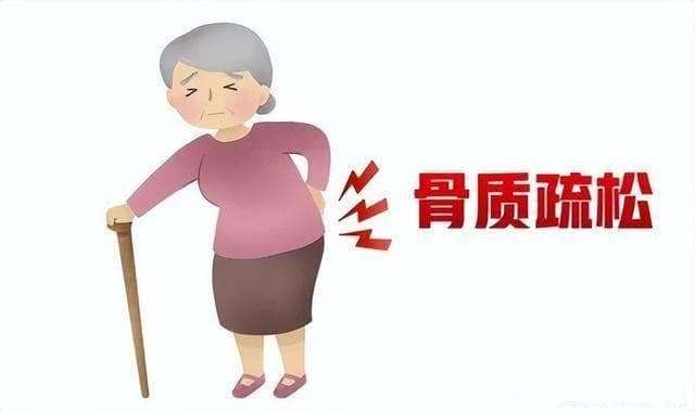 协和医生带您吃出健康 | 骨质疏松患者怎么吃？