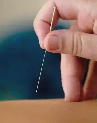 中医外治疗法治疗白发病