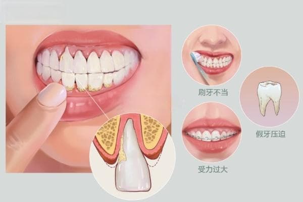 困扰国人的七大口腔问题你有几个？看看哪些日常口腔护理技巧你还不知道？