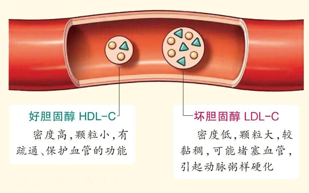 坏胆固醇（LDL-C）只要降到2.6，就都安全了？
