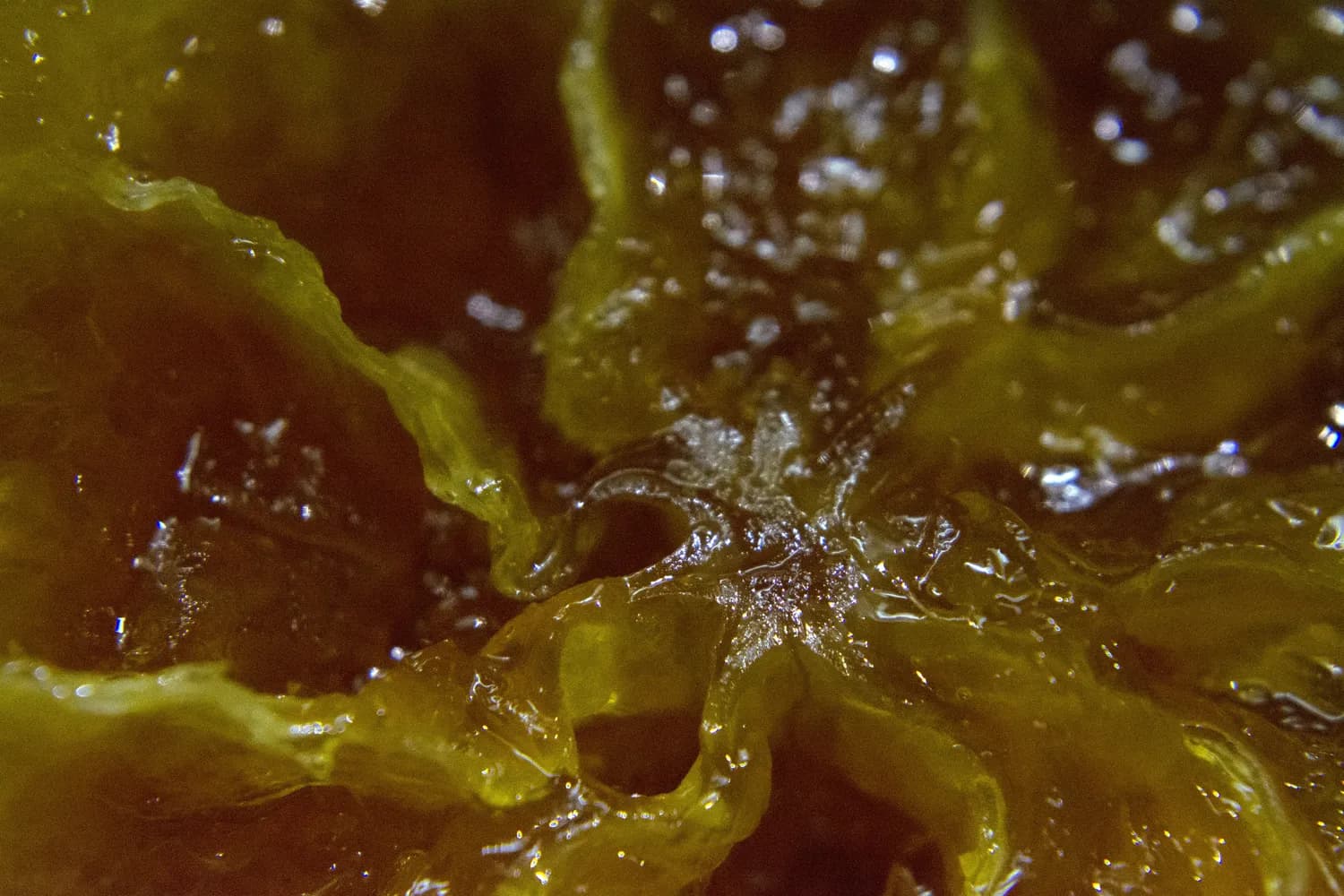 慢性支气管炎：黄色痰液的秘密
