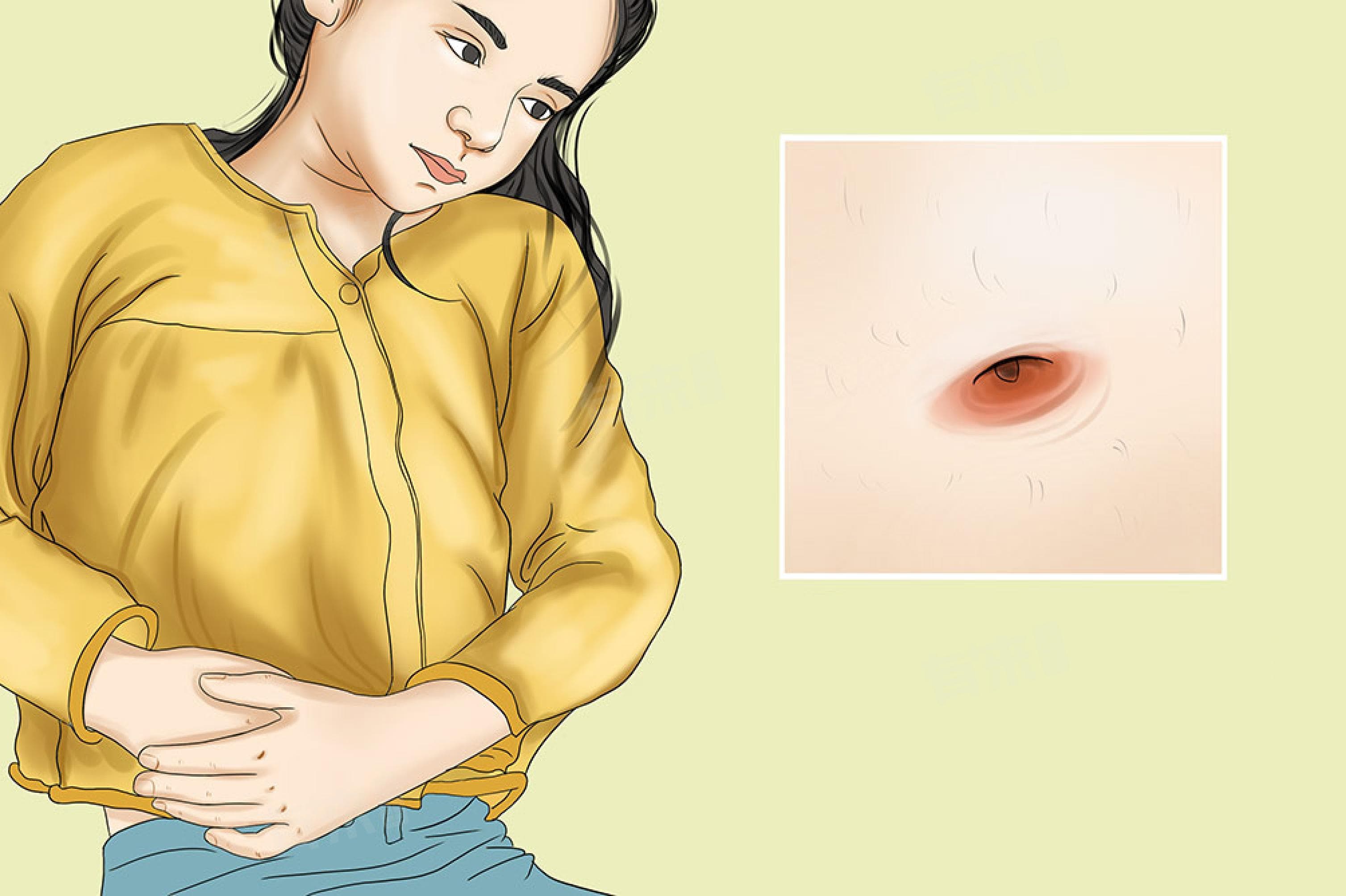 肚脐眼正中间里面疼怎么办？可能的原因及处理方法