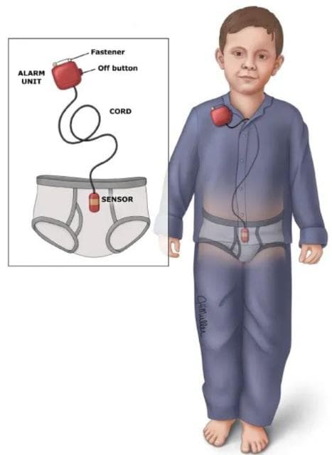 人类幼崽是怎么告别夜间尿床的？为什么有些人类长大了仍尿床？