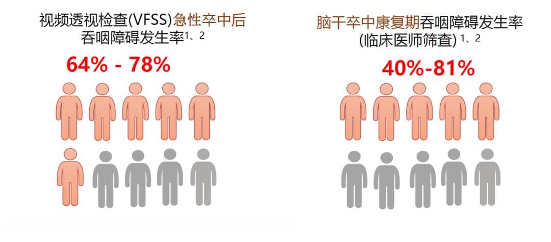 吞咽障碍康复——导管球囊扩张术的临床应用