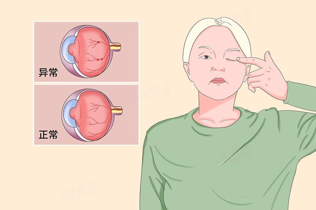 糖尿病眼睛看不清楚了,还能恢复吗