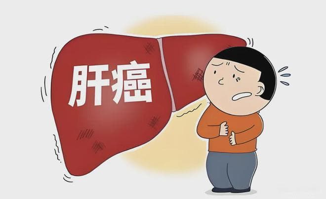 中医治疗肝癌：传统医学智慧与现代医疗技术的融合与革新