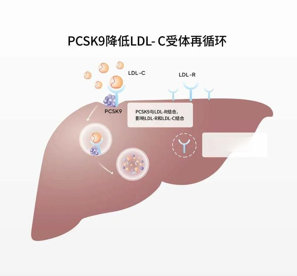 抢跑国产PCSK9赛道！信达生物「托莱西单抗」率先“上岸”