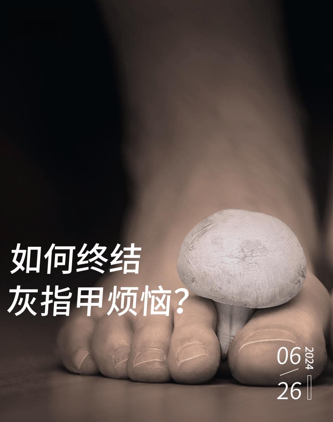 80后中年男：被灰指甲折磨多年，妻子嫌弃，心态崩溃，还有救吗？