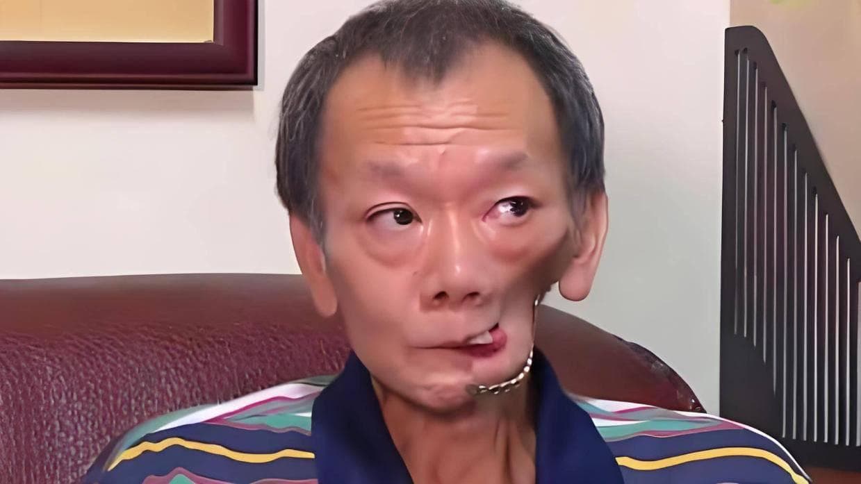 咀嚼槟榔对口腔和牙齿的危害原理及其影响