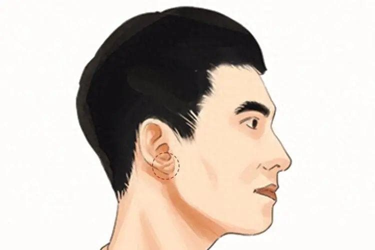耳朵上有这条折痕，是心梗、猝死的“标志”？