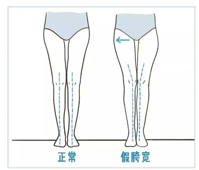 产后恢复仪器