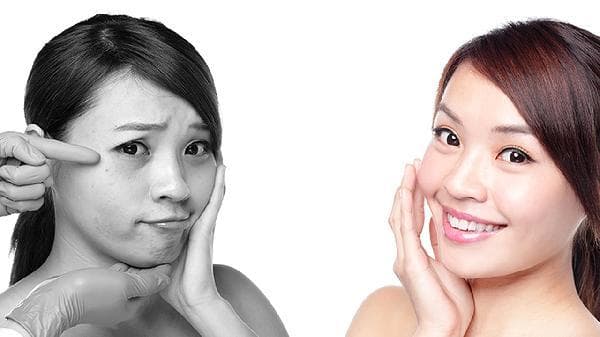 冬季护肤指南：六步预防皮肤皴裂