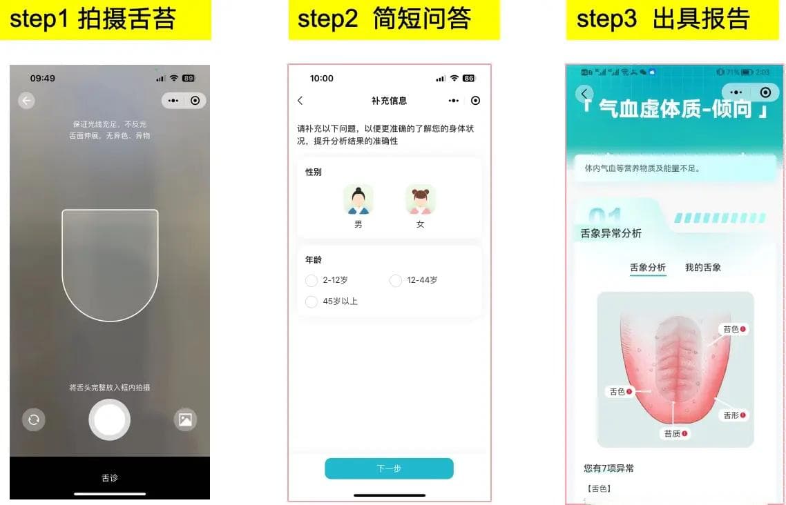 智能中医舌诊：图像识别技术在传统医学中的应用