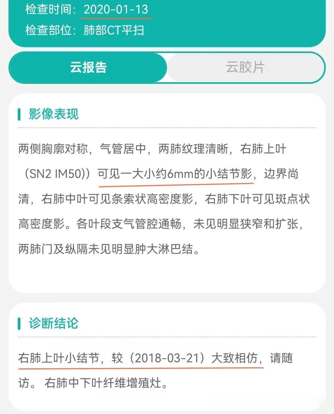 病例分享：随访6年，吃中药近2年，她的肺结节好了吗？