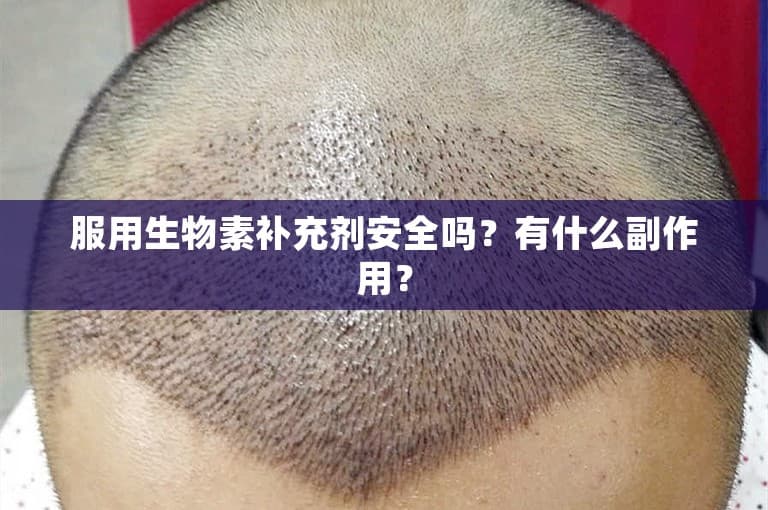 服用生物素补充剂安全吗？有什么副作用？