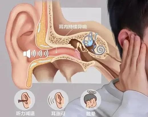 中医辨证施治：五种耳鸣类型及治疗方法