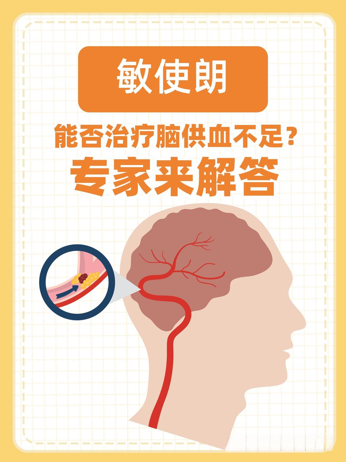 敏使朗能否治疗脑供血不足？专家来解答
