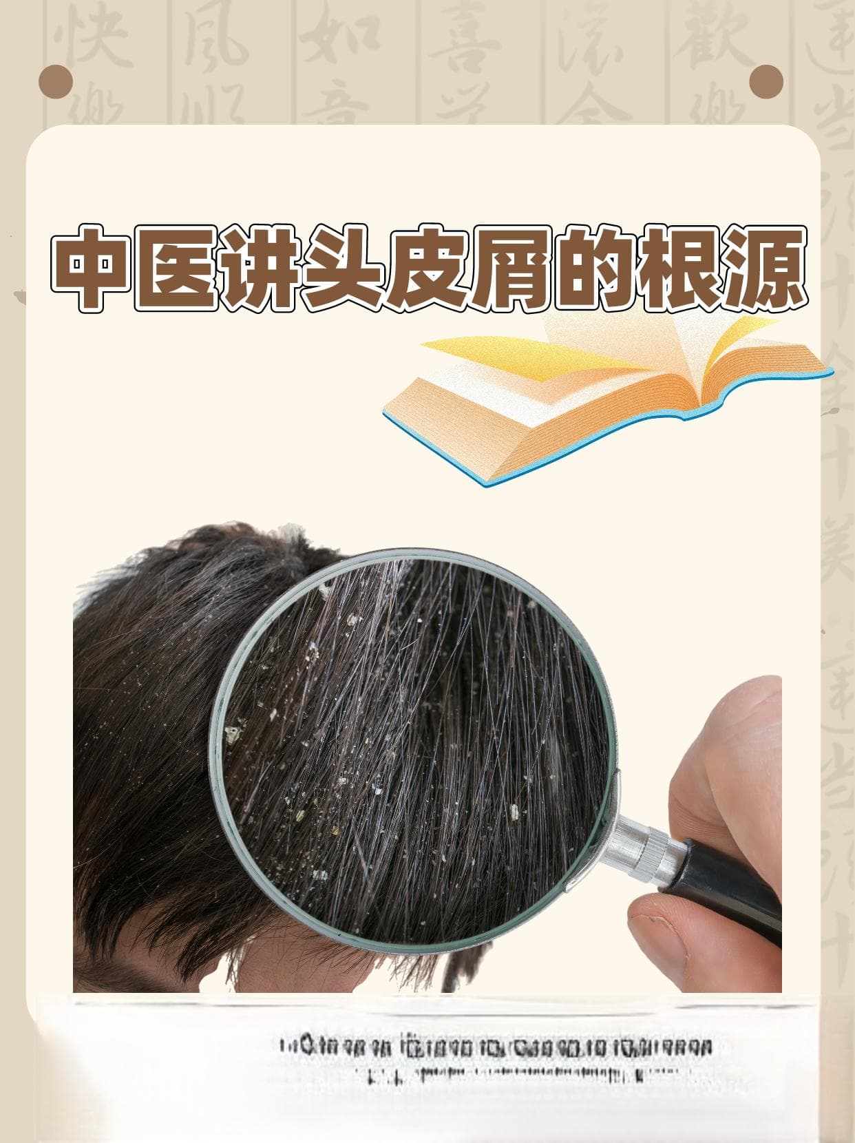 探寻中医讲头皮屑的根源