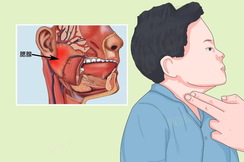 什么是痄腮？症状、传播途径及预防措施全解析