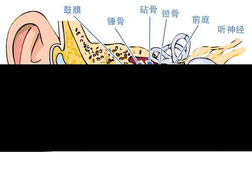 听力问题与耳鸣：症状和治疗方法