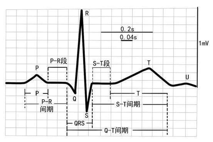 理想心率是多少