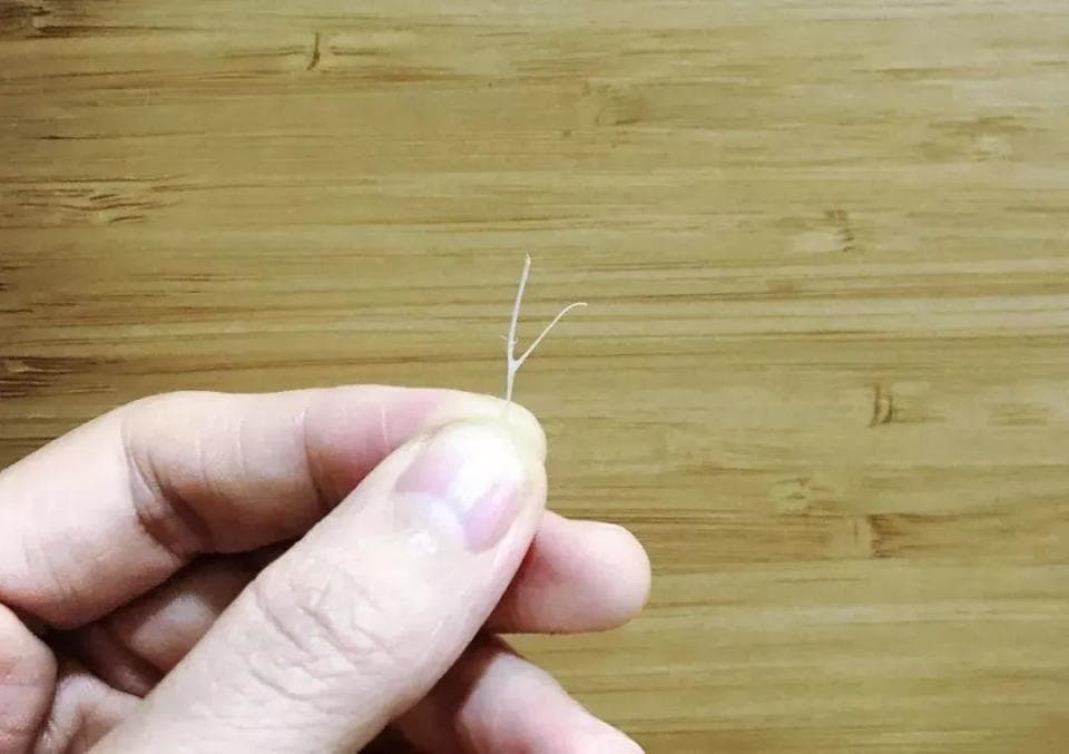 卡了鱼刺，别再喝醋吞米饭了！只用两招，鱼刺自己“跑出来”