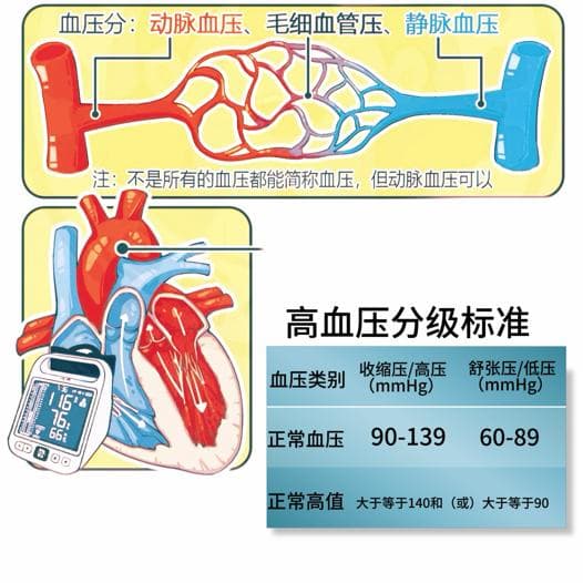 测量血压的正确方法：避免走入误区