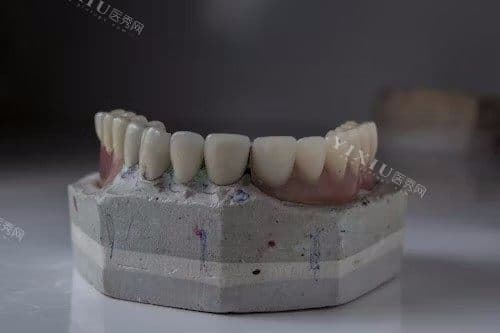 牙齿的结构组成大揭秘全解析！牙冠牙根牙颈三部分缺一不可，快来了解牙齿的奥秘吧！