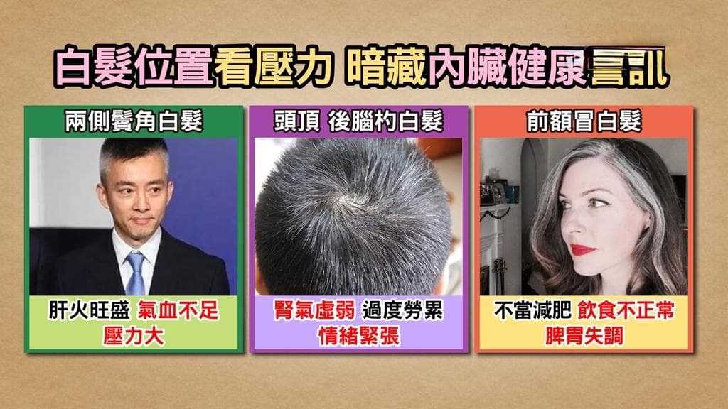 白发原因有哪些？4种白发位置透露健康警讯！白发变黑发秘诀