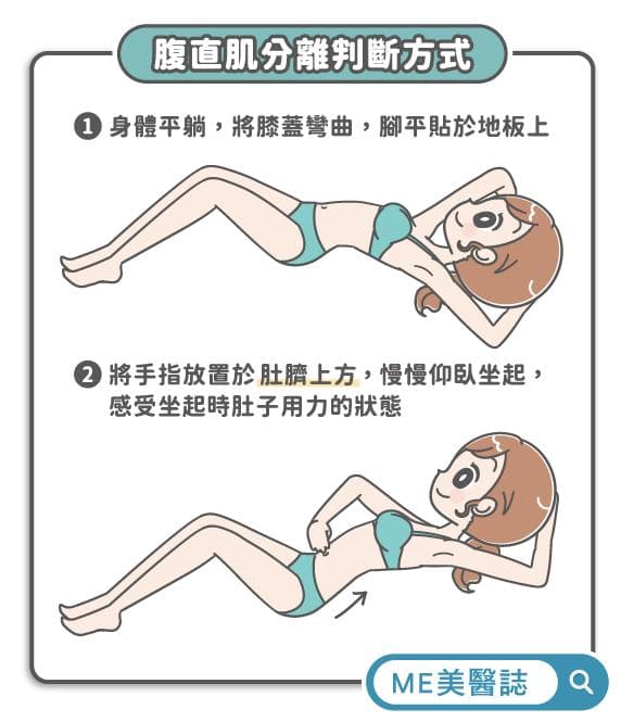 产后腹直肌分离怎么办？三种治疗方式全解析