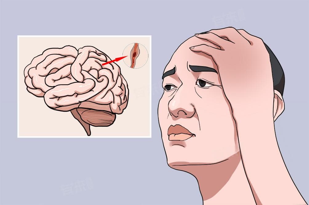 脑供血不足是何疾病