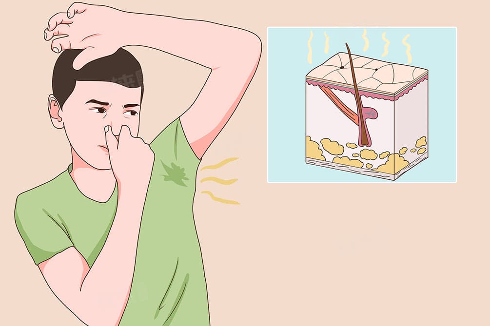 腋下怎么除臭