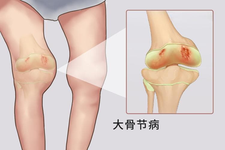 人体必需元素硒，可以杀死癌细胞？适当多吃4种食物，不怕缺硒