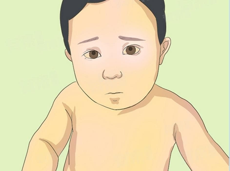 肝功能总胆红素偏高说明什么