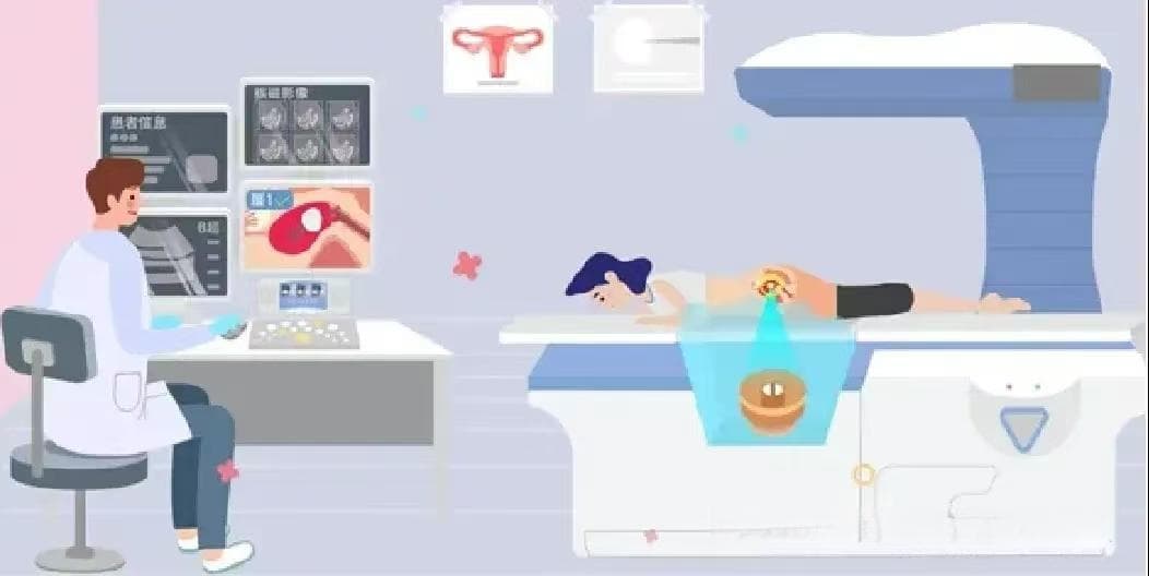 “海扶刀”无创治疗技术：原理、优势及应用
