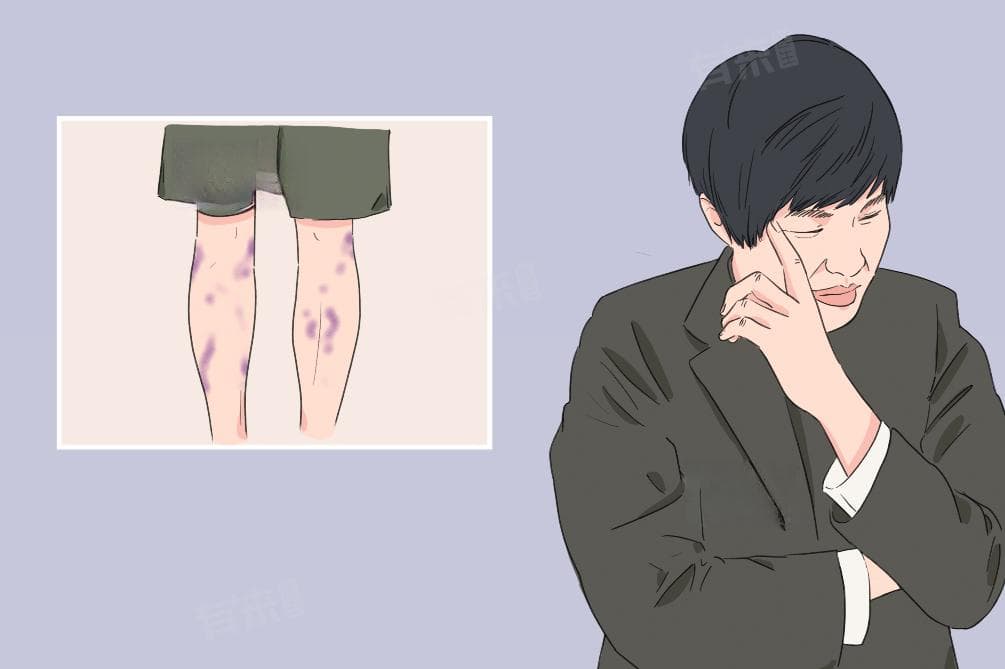 腿上出现红色小圆点怎么办？原因分析与应对方法
